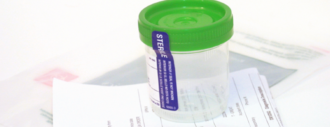 Drug Testing Albany, Ga